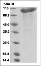 Human Semaphorin 3A / SEMA3A Protein (Fc Tag) SDS-PAGE