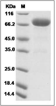 Canine IL13RA2 / IL13R Protein (Fc Tag) SDS-PAGE