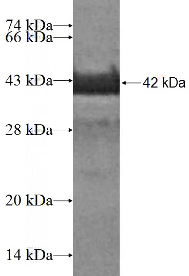 Recombinant Human MED10 SDS-PAGE