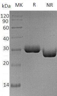 Human BTN3A2/BT3.2/BTF3/BTF4 (His tag) recombinant protein