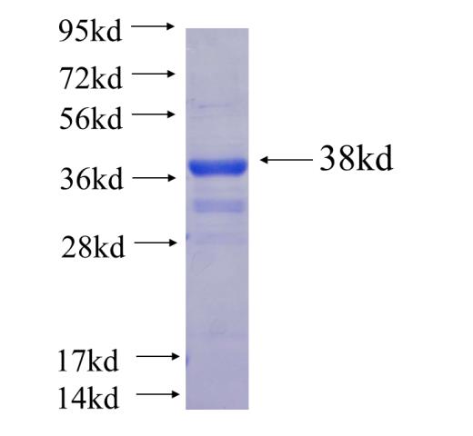 Recombinant Arabidopsis thaliana HSI2-L1 SDS-PAGE