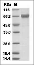 Influenza A H3N2 (A/Netherlands/178/1995) (RG145K) Hemagglutinin / HA Protein (His Tag)