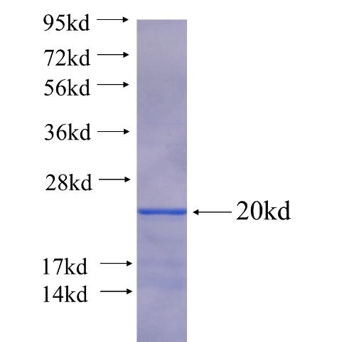 Recombinant human FOXR1 SDS-PAGE