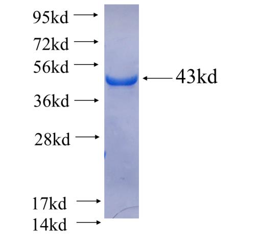 Recombinant human WDR41 SDS-PAGE