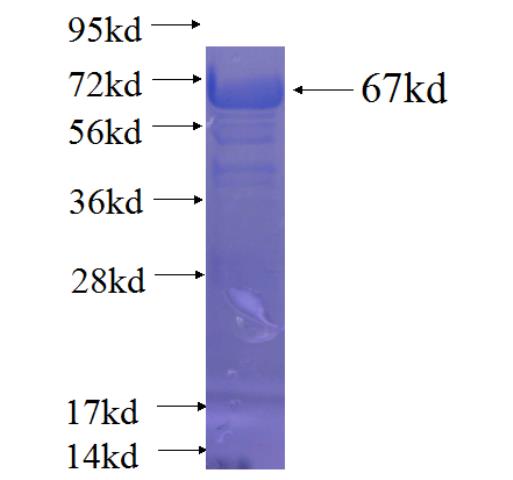 Recombinant human FGFR1OP SDS-PAGE
