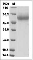 Influenza A H1N1 (A/Swine/Wisconsin/136/1997) Hemagglutinin / HA1 Protein (His Tag)