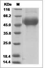 Influenza A H9N5 (A/shorebird/DE/261/2003) Hemagglutinin /HA1 Protein (His Tag)