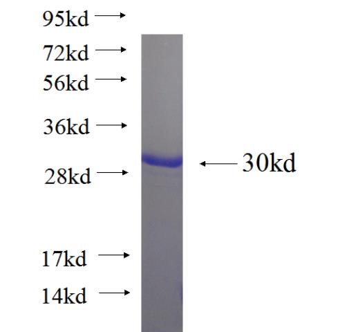 Recombinant human C4orf18 SDS-PAGE