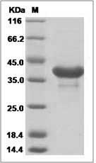 Mouse CD81 / TAPA-1 Protein (Fc Tag)