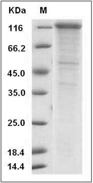 Rat Cadherin-17 / LI-cadherin / CDH17 Protein (His Tag) SDS-PAGE