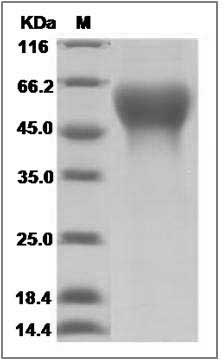 Influenza A H5N1 (A/barnswallow/Hong Kong/D10-1161/2010) Hemagglutinin Protein (HA1 Subunit) (His Tag) SDS-PAGE