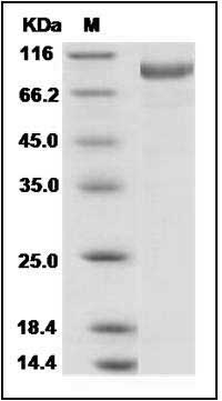 Novel coronavirus (HCoV-EMC/2012) Spike Protein S1 Protein (aa 1-725, His Tag) SDS-PAGE