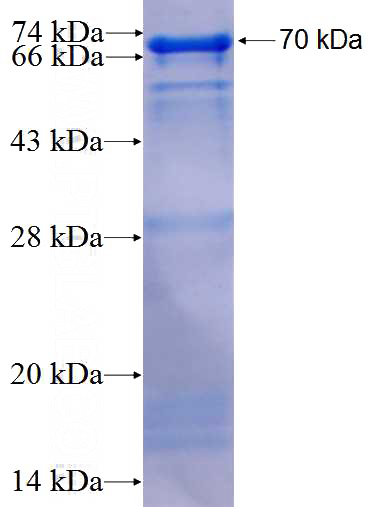 Recombinant Human TPX2 SDS-PAGE