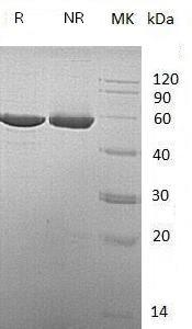 Mouse Cndp2/Cn2 (His tag) recombinant protein