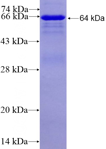 Recombinant Human PPM1F SDS-PAGE