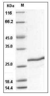 Mouse SDF2 / SDF-2 Protein (His Tag) SDS-PAGE