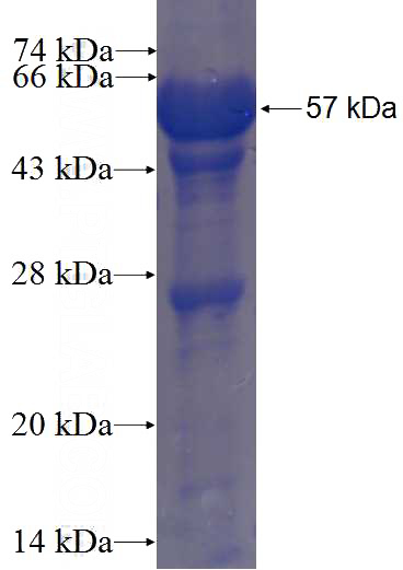 Recombinant Human SULT6B1 SDS-PAGE