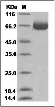Influenza A H15N2 (A/Australian shelduck/Western Australia/1756/1983) Hemagglutinin / HA Protein (His Tag) SDS-PAGE