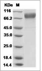 Influenza A H3N2 (A/Victoria/361/2011) Hemagglutinin / HA Protein (His Tag)
