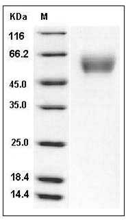 Human SerpinA6 / CBG Protein (His Tag) SDS-PAGE