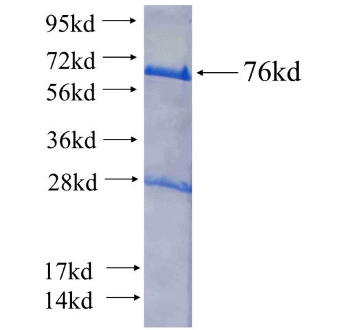 Recombinant human THOC1 SDS-PAGE