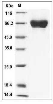 Influenza A H5N3 (A/duck/Hokkaido/167/2007) Hemagglutinin / HA Protein (His Tag) SDS-PAGE
