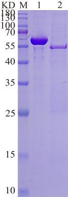 M: Maker; Lane 1: 0.5 mg/mL BSA; Lane 2: BETA-TRCP,BTRC (GST tag)