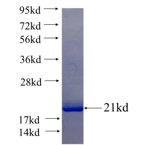 Recombinant human C6orf125 SDS-PAGE