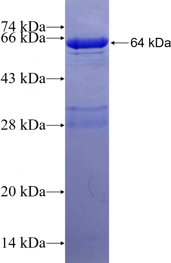 Recombinant Human EIF5B SDS-PAGE