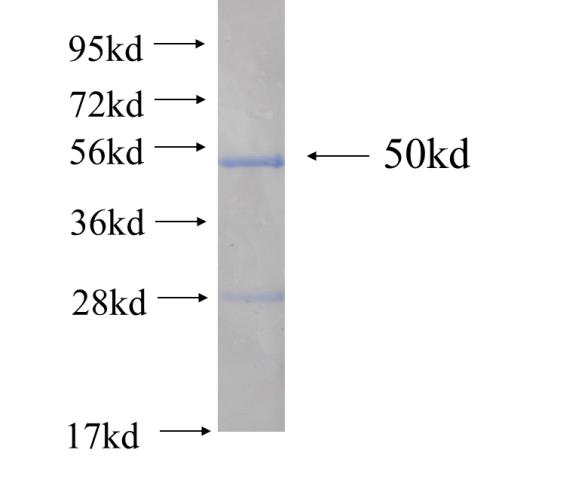 Recombinant human RGS2(Full length) SDS-PAGE
