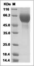 Influenza A H3N2 (A/Beijing/32/92) Hemagglutinin / HA1 Protein (His Tag)