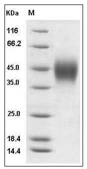 Mouse IFNGR1 / CD119 Protein (His Tag) SDS-PAGE