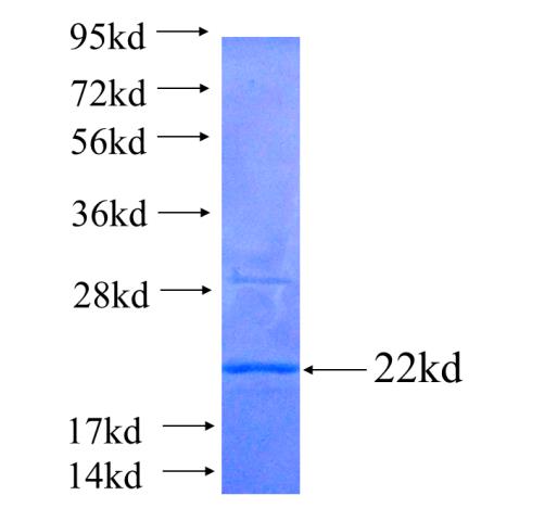 Recombinant human ATP5H(Full length) SDS-PAGE