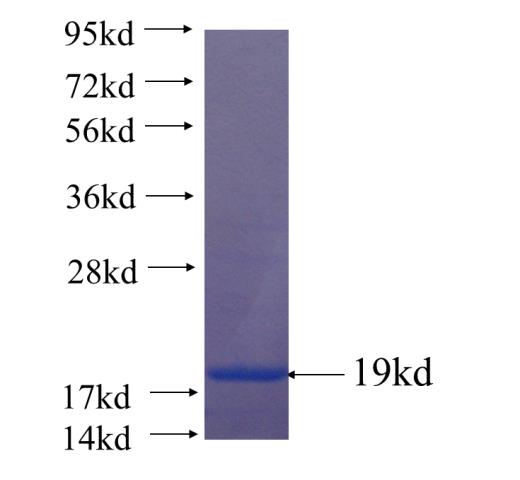 Recombinant human REM2 SDS-PAGE