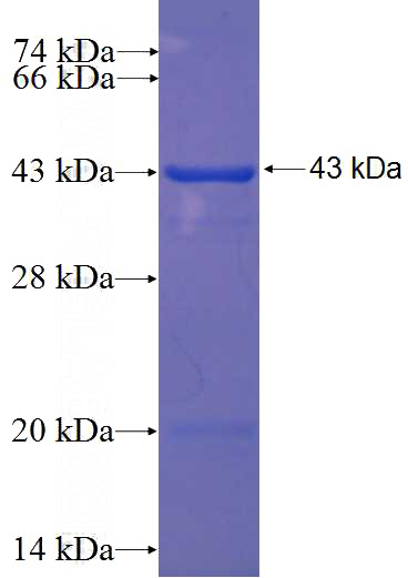 Recombinant Human C1orf116 SDS-PAGE
