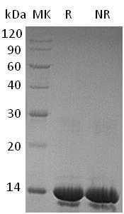 Human CSTA/STF1/STFA (His tag) recombinant protein
