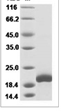 Human IL6/IL-6/Interleukin-6 Protein 14107