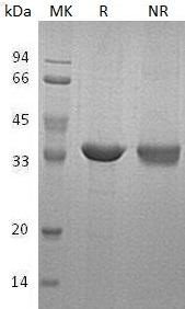 Human STUB1/CHIP/PP1131 recombinant protein