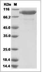 Rat IL-6R / CD126 Protein (Fc Tag)