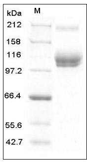 Mouse ALCAM / CD166 Protein (His & Fc Tag) SDS-PAGE