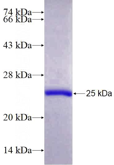 Recombinant Human NME6 SDS-PAGE