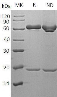 Human PCSK9/NARC1/PSEC0052 (His tag) recombinant protein