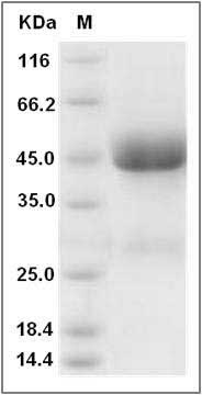 Rat IL13RA2 / IL13R Protein (His Tag) SDS-PAGE