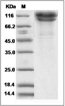 Rat CDH13 / Cadherin-13 / H Cadherin Protein (His Tag) SDS-PAGE