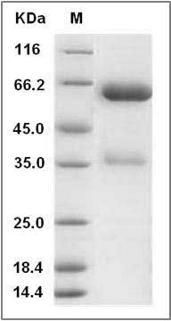 Rat EpCAM / TROP-1 / TACSTD1 Protein (Fc Tag) SDS-PAGE