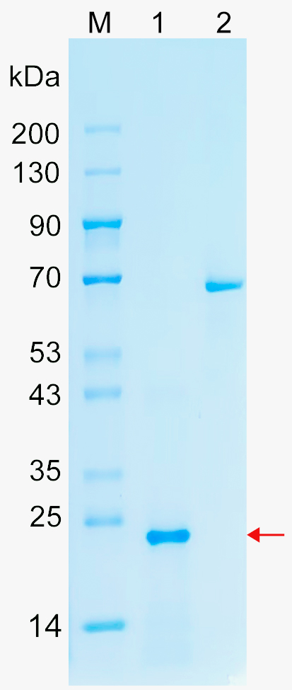 Recombinant ZFP91 protein (His tag) SDS-PAGE