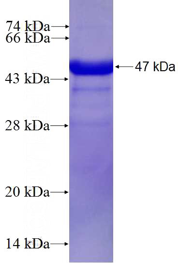 Recombinant Human RAD52 SDS-PAGE