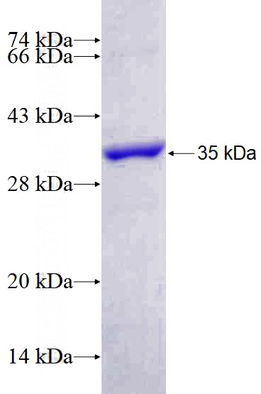 Recombinant Human COPE SDS-PAGE