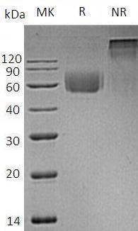 Human IL1RL2/IL1RRP2 (His tag) recombinant protein