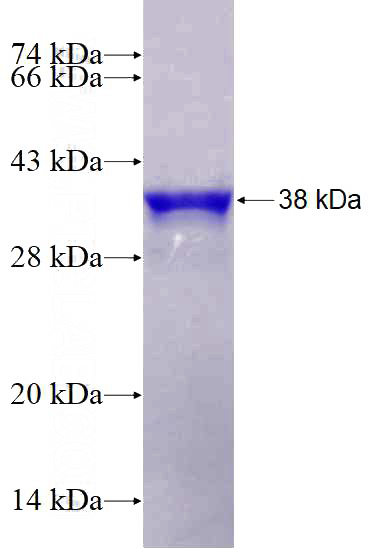 Recombinant Human FXC1 SDS-PAGE